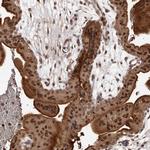 PRR12 Antibody in Immunohistochemistry (Paraffin) (IHC (P))