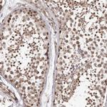 PRR12 Antibody in Immunohistochemistry (Paraffin) (IHC (P))