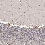 PRR12 Antibody in Immunohistochemistry (IHC)