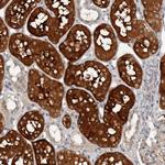Calpain 15 Antibody in Immunohistochemistry (Paraffin) (IHC (P))