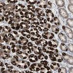 TTMP Polyclonal Antibody