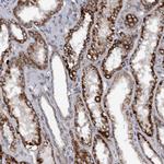 Monoacylglycerol Lipase Antibody in Immunohistochemistry (IHC)
