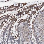 Monoacylglycerol Lipase Antibody in Immunohistochemistry (IHC)