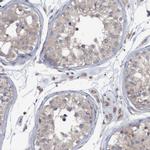 Monoacylglycerol Lipase Polyclonal Antibody