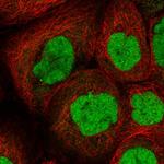 CHD4 Polyclonal Antibody