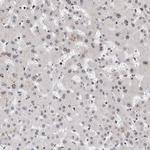 CHD4 Antibody in Immunohistochemistry (Paraffin) (IHC (P))