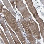 PANK4 Polyclonal Antibody