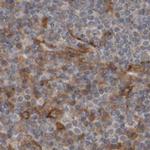 ARHGEF11 Antibody in Immunohistochemistry (IHC)