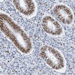 THRAP3 Antibody in Immunohistochemistry (Paraffin) (IHC (P))