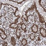 THRAP3 Antibody in Immunohistochemistry (Paraffin) (IHC (P))