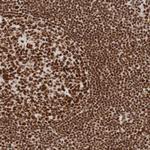 THRAP3 Antibody in Immunohistochemistry (Paraffin) (IHC (P))