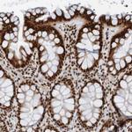 THRAP3 Antibody in Immunohistochemistry (IHC)