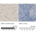 Centaurin alpha-1 Antibody in Immunohistochemistry (IHC)