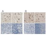 Centaurin alpha-1 Antibody in Immunohistochemistry (IHC)