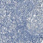 Centaurin alpha-1 Antibody in Immunohistochemistry (IHC)