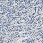 Centaurin alpha-1 Antibody in Immunohistochemistry (IHC)