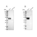 Cytokeratin 23 Antibody in Western Blot (WB)