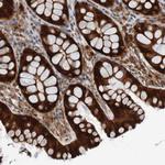 CPED1 Antibody in Immunohistochemistry (Paraffin) (IHC (P))