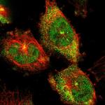 SGK223 Polyclonal Antibody