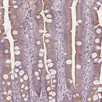 SGK223 Antibody in Immunohistochemistry (Paraffin) (IHC (P))