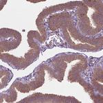 SGK223 Antibody in Immunohistochemistry (Paraffin) (IHC (P))