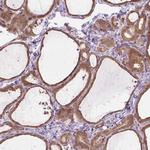 SGK223 Antibody in Immunohistochemistry (Paraffin) (IHC (P))