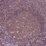 SGK223 Antibody in Immunohistochemistry (Paraffin) (IHC (P))