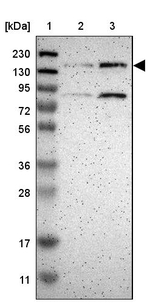 SGK223 Antibody in Western Blot (WB)