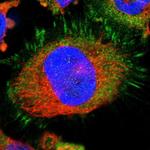 LASP1 Polyclonal Antibody