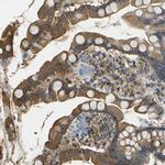 LASP1 Antibody in Immunohistochemistry (IHC)
