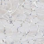 LASP1 Antibody in Immunohistochemistry (IHC)