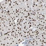 USP36 Antibody in Immunohistochemistry (Paraffin) (IHC (P))