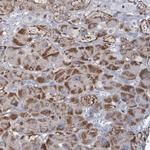 C3orf18 Antibody in Immunohistochemistry (Paraffin) (IHC (P))