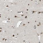 JHDM1D Antibody in Immunohistochemistry (Paraffin) (IHC (P))