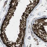 C11orf48 Antibody in Immunohistochemistry (Paraffin) (IHC (P))