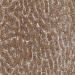 DHRS7B Antibody in Immunohistochemistry (Paraffin) (IHC (P))