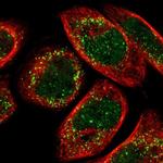 ACBD5 Polyclonal Antibody