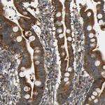 TMEM25 Antibody in Immunohistochemistry (IHC)
