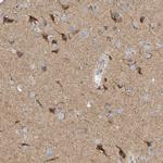 LMBRD2 Antibody in Immunohistochemistry (Paraffin) (IHC (P))