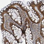 LMBRD2 Antibody in Immunohistochemistry (Paraffin) (IHC (P))