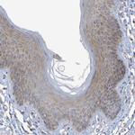 LMBRD2 Antibody in Immunohistochemistry (Paraffin) (IHC (P))