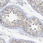 LMBRD2 Antibody in Immunohistochemistry (Paraffin) (IHC (P))