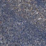 INPP5A Polyclonal Antibody