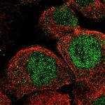 CCRN4L Polyclonal Antibody