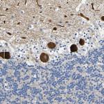 CCRN4L Antibody in Immunohistochemistry (Paraffin) (IHC (P))
