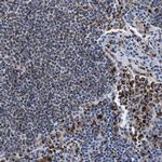 HLA-DMB Polyclonal Antibody