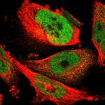 FAM172A Polyclonal Antibody