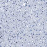 RNF182 Antibody in Immunohistochemistry (Paraffin) (IHC (P))