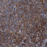 RNF182 Polyclonal Antibody