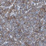 RNF182 Antibody in Immunohistochemistry (Paraffin) (IHC (P))
